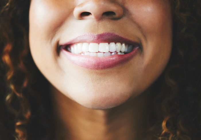 3 Treatments for a Whiter Smile