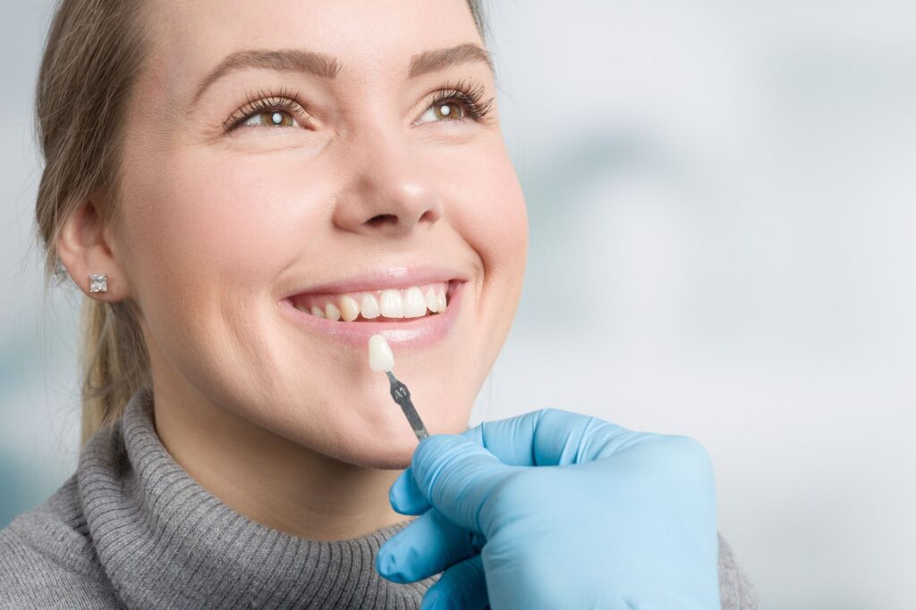 Aftercare for Your Porcelain Veneers