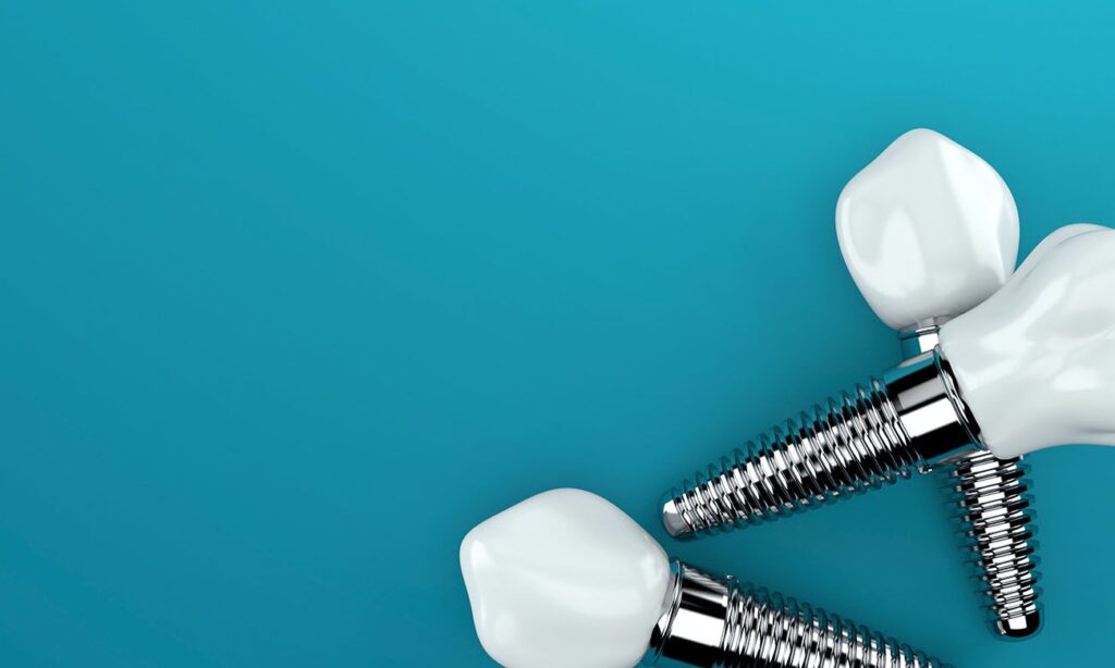 Know the Dental Implant Types