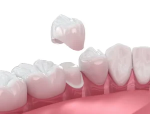 Same-Day Crowns? How Digital Dentistry Works in Sahuarita, AZ