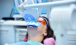 Professional Teeth Whitening vs. Drugstore Kits in Sahuarita, AZ
